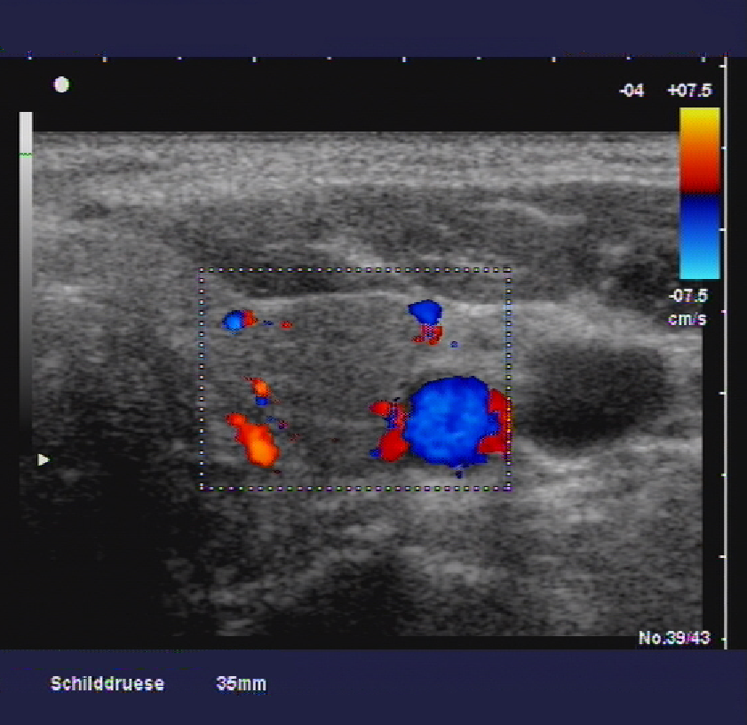 Sonographie